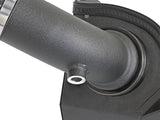 aFe Takeda Stage-2 Pro DRY S Air Intake System 15-17 Ford Focus ST L4-2.0L (t) EcoBoost - TR-5306B-D