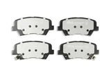 DBA 17-20 Hyundai Elantra (w/280mm Front Rotor) 2.0L Front SSEV Street Series Brake Pads - DB2443SSEV