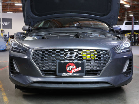 aFe 18-20 Hyundai Elantra GT L4-1.6L (t) Takeda Momentum Dynamic Air Scoop - Neon Green - 56-70005SE