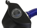aFe Takeda Intakes Stage-2 P5R AIS 2016 Lexus RC 2.0L - Blue - TM-2018L-R